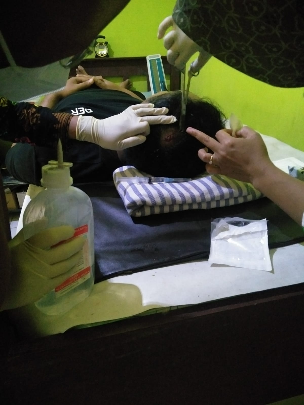 Salah seorang guru di SDN Kledung I Kecamatan Bandar harus mendapatkan tujuh jahitan